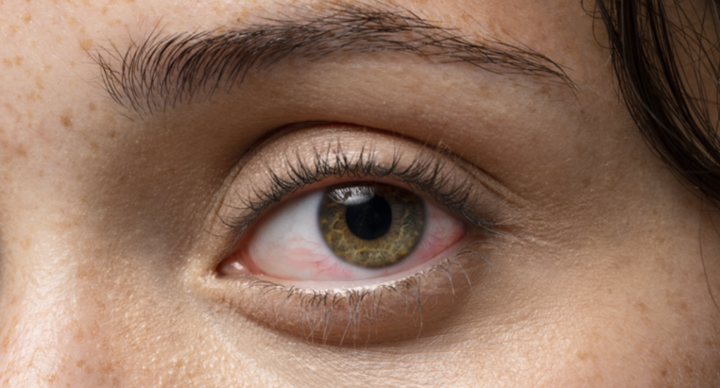 Nhận biết các dấu hiệu mắt bị ảnh hưởng bởi ánh sáng